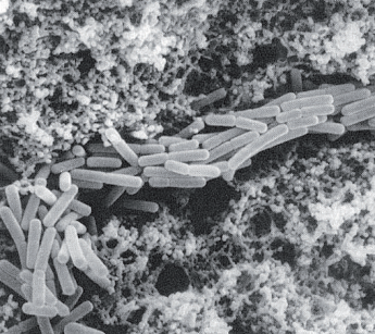 Figura 1 – Immagine al microscopio elettronico di cagliata contenente lattobacilli termofili da sieroinnesto naturale