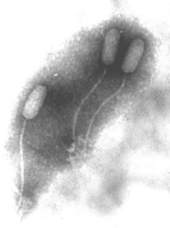 Figura 1 – Microfotografia al microscopio elettronico di batteriofagi: fago temperato di Lactobacillus delbrueckii (a)