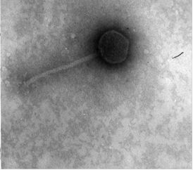 Figura 1 – Microfotografia al microscopio elettronico di batteriofagi: fago litico di Lactobacillus plantarum (b)