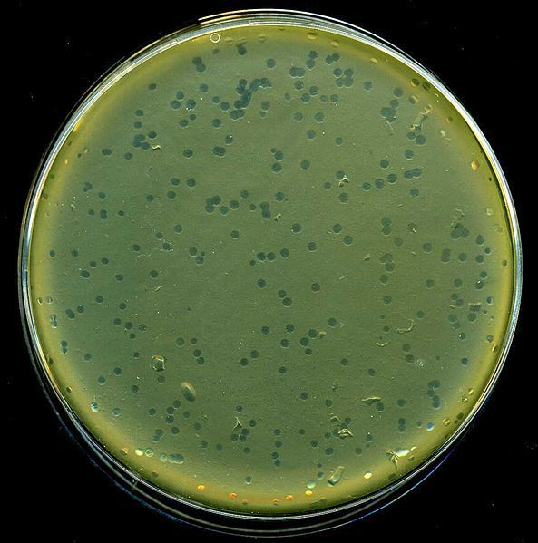 Figura 2 – Coltura batterica infettata da batteriofagi. Sono visibili le aree di lisi, o placche, dove i batteri sono stati lisati dal virus. Le placche si possono contare e consentono la conta dei fagi
