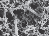 Figura 2 – Immagine al microscopio elettronico di starter di lattobacilli produttori di esopolisaccaridi, simili a filamenti posti sulla parete cellulare